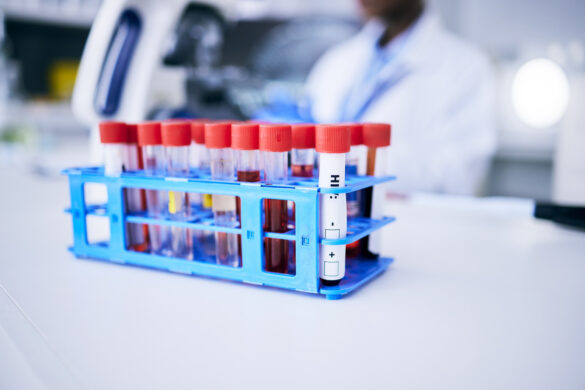 CBD Drug Test